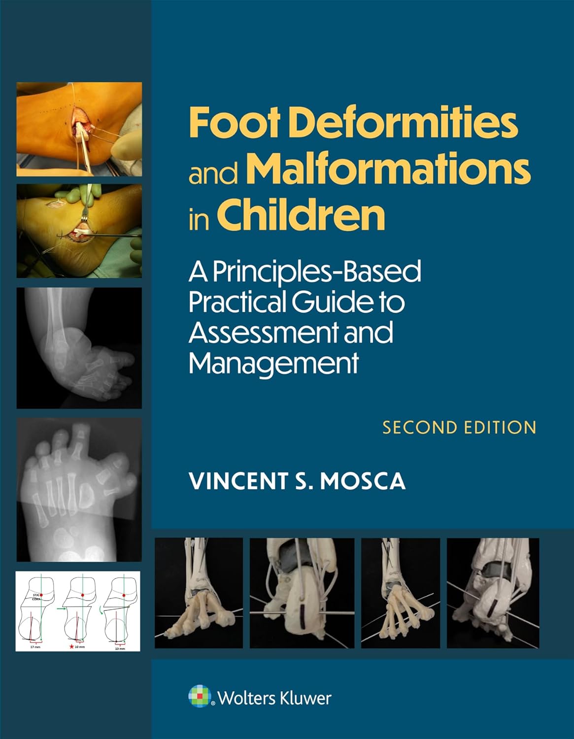 Foot Deformities and Malformations in Children: A Principles-Based, Practical Guide to Assessment and Management: eBook without Multimedia