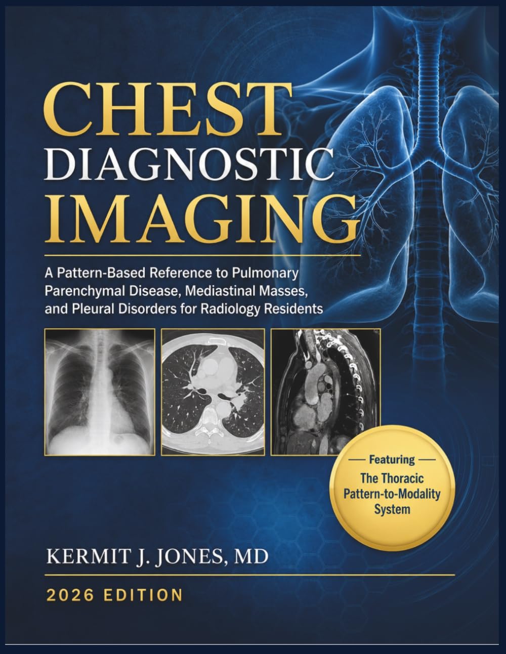 Chest Diagnostic Imaging 2026: A Pattern-Based Reference to Pulmonary Parenchymal Disease, Mediastinal Masses, and Pleural Disorders for Radiology Residents